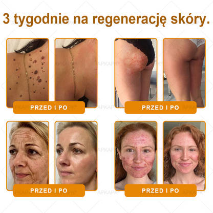 🐝ΑPΚΑPK® Jad Pszczoły Kompleksowy Krem✨pomaga w leczeniu problemów skórnych, takich jak: zmarszczki, blizny, plamy pigmentacyjne, rozstępy, trądzik, łuszczyca, egzema, zmiany skórne, podrażnienia, stany zapalne i inne problemy skórne🔥