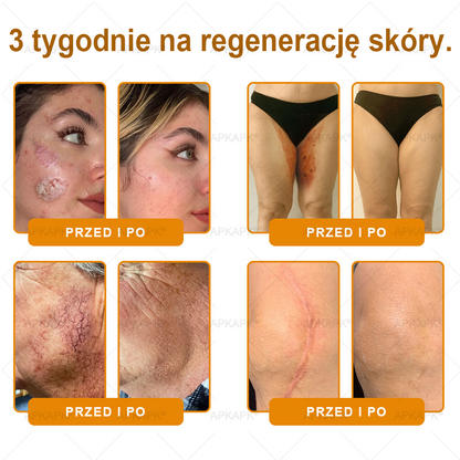 🐝ΑPΚΑPK® Jad Pszczoły Kompleksowy Krem✨pomaga w leczeniu problemów skórnych, takich jak: zmarszczki, blizny, plamy pigmentacyjne, rozstępy, trądzik, łuszczyca, egzema, zmiany skórne, podrażnienia, stany zapalne i inne problemy skórne🔥