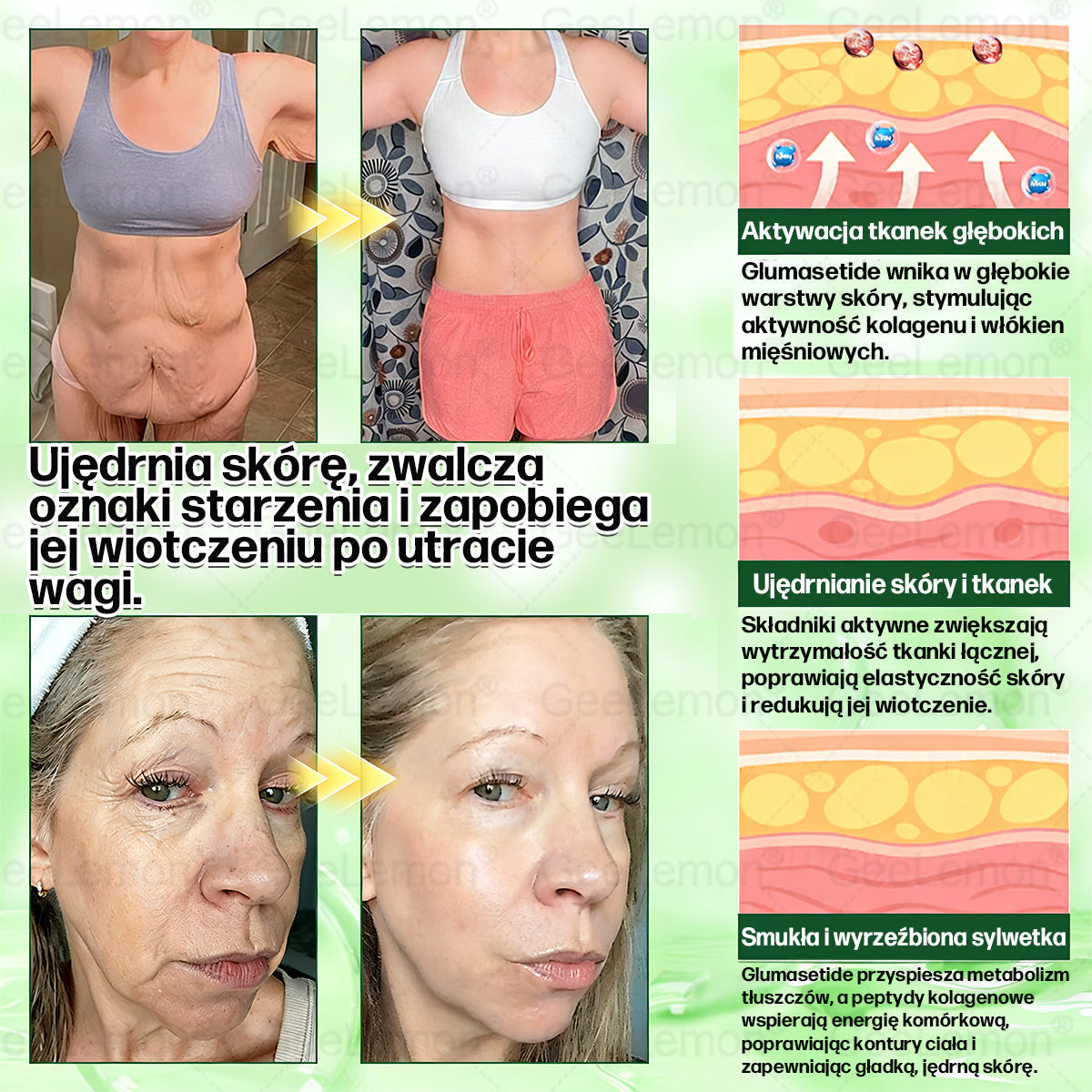 💖Oficjalny Sklep | 👩‍⚕️🎁 𝐆𝐞𝑒𝐿𝑒𝐦𝐨𝐧® 𝐆𝐥𝐮𝐦ase𝐭𝐢𝐝𝐞 𝟖 𝐰 𝟏 Smukły i Zdrowy Nano Plaster z Mikronakłuciami 🇵🇱(Tylko raz dziennie, widoczne zmiany już w 7 dni)✅ Na otyłość, 🅛🅞🅞🅢🅔 🅢🅚🅘🅝 wiotką skórę, cukrzycę, bezdech senny, problemy ze stawami i wiele więcej