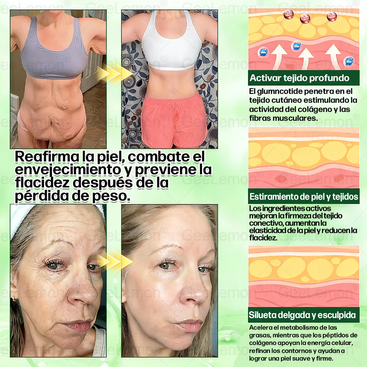 𝐆𝐞𝐞𝐋𝐞𝐦𝐨𝐧® 𝐆𝐥𝐮𝐦𝐚𝐬𝐞𝐭𝐢𝐝𝐚 𝟖 𝐞𝐧 𝟏 𝐏𝐚𝐫𝐜𝐡𝐞 𝐍𝐚𝐧𝐨 𝐌𝐢𝐜𝐫𝐨𝐚𝐠𝐮𝐣𝐚𝐬 𝐏𝐚𝐫𝐚 𝐀𝐝𝐞𝐥𝐠𝐚𝐳𝐚𝐫 𝐲 𝐒𝐚𝐥𝐮𝐝 (Solo una vez al día, cambios visibles en 7 días) Para obesidad, salud cardiovascular, diabetes, apnea del sueño, glándula tiroides, salud intestinal, problemas articulares y más
