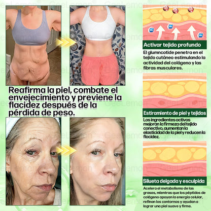 𝐆𝐞𝐞𝐋𝐞𝐦𝐨𝐧® 𝐆𝐥𝐮𝐦𝐚𝐬𝐞𝐭𝐢𝐝𝐚 𝟖 𝐞𝐧 𝟏 𝐏𝐚𝐫𝐜𝐡𝐞 𝐍𝐚𝐧𝐨 𝐌𝐢𝐜𝐫𝐨𝐚𝐠𝐮𝐣𝐚𝐬 𝐏𝐚𝐫𝐚 𝐀𝐝𝐞𝐥𝐠𝐚𝐳𝐚𝐫 𝐲 𝐒𝐚𝐥𝐮𝐝 (Solo una vez al día, cambios visibles en 7 días) Para obesidad, salud cardiovascular, diabetes, apnea del sueño, glándula tiroides, salud intestinal, problemas articulares y más