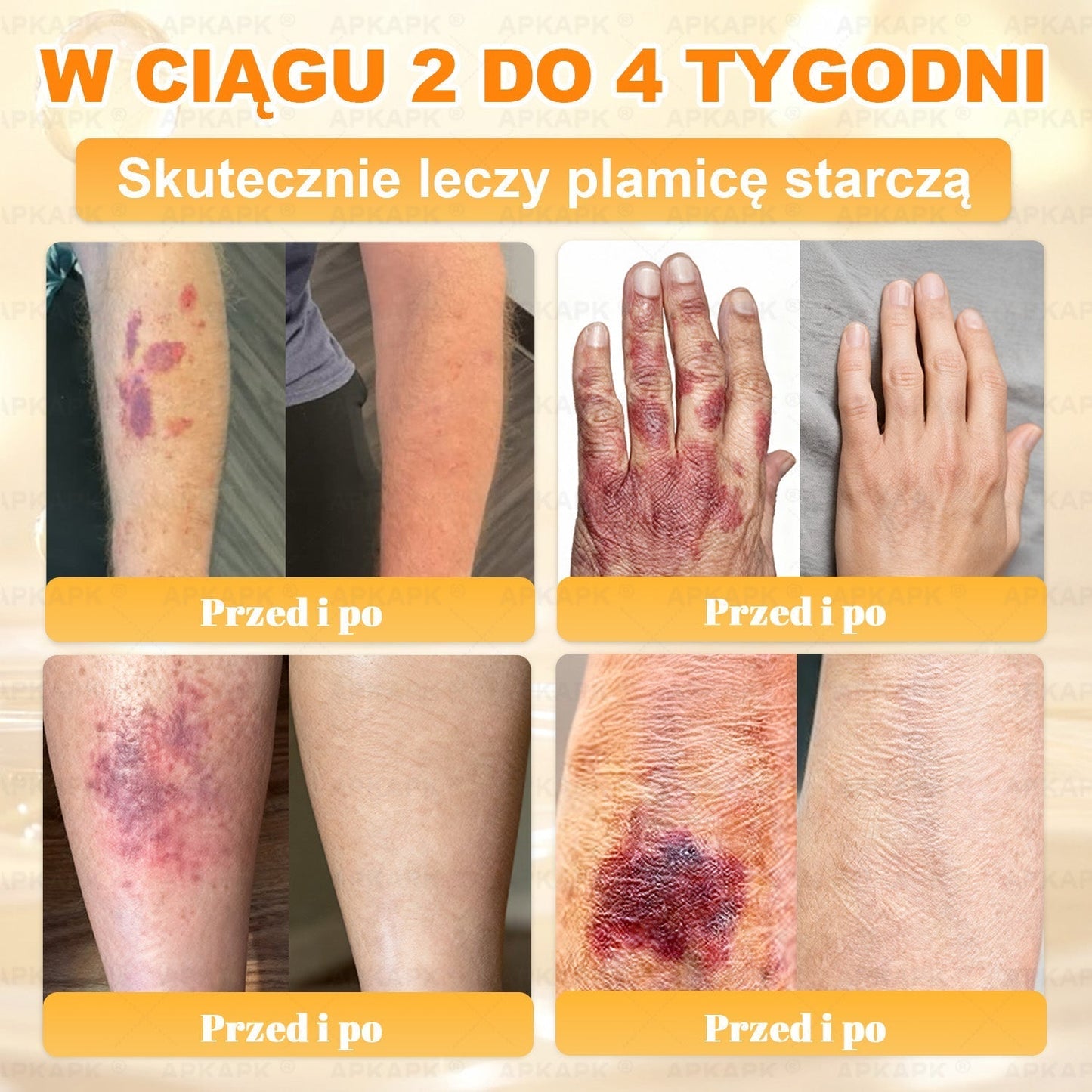 🐝ΑPΚΑPK® Jad Pszczoły Kompleksowy Krem✨pomaga w leczeniu problemów skórnych, takich jak: zmarszczki, blizny, plamy pigmentacyjne, rozstępy, trądzik, łuszczyca, egzema, zmiany skórne, podrażnienia, stany zapalne i inne problemy skórne🔥