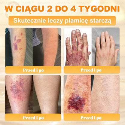 🐝ΑPΚΑPK® Jad Pszczoły Kompleksowy Krem✨pomaga w leczeniu problemów skórnych, takich jak: zmarszczki, blizny, plamy pigmentacyjne, rozstępy, trądzik, łuszczyca, egzema, zmiany skórne, podrażnienia, stany zapalne i inne problemy skórne🔥