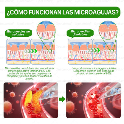 𝐆𝐞𝐞𝐋𝐞𝐦𝐨𝐧® 𝐆𝐥𝐮𝐦𝐚𝐬𝐞𝐭𝐢𝐝𝐚 𝟖 𝐞𝐧 𝟏 𝐏𝐚𝐫𝐜𝐡𝐞 𝐍𝐚𝐧𝐨 𝐌𝐢𝐜𝐫𝐨𝐚𝐠𝐮𝐣𝐚𝐬 𝐏𝐚𝐫𝐚 𝐀𝐝𝐞𝐥𝐠𝐚𝐳𝐚𝐫 𝐲 𝐒𝐚𝐥𝐮𝐝 (Solo una vez al día, cambios visibles en 7 días) Para obesidad, salud cardiovascular, diabetes, apnea del sueño, glándula tiroides, salud intestinal, problemas articulares y más