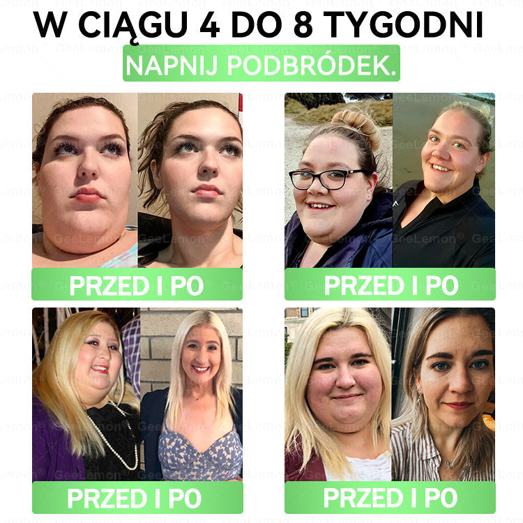 💖Oficjalny Sklep | 👩‍⚕️🎁 𝐆𝐞𝑒𝐿𝑒𝐦𝐨𝐧® 𝐆𝐥𝐮𝐦ase𝐭𝐢𝐝𝐞 𝟖 𝐰 𝟏 Smukły i Zdrowy Nano Plaster z Mikronakłuciami 🇵🇱(Tylko raz dziennie, widoczne zmiany już w 7 dni)✅ Na otyłość, 🅛🅞🅞🅢🅔 🅢🅚🅘🅝 wiotką skórę, cukrzycę, bezdech senny, problemy ze stawami i wiele więcej