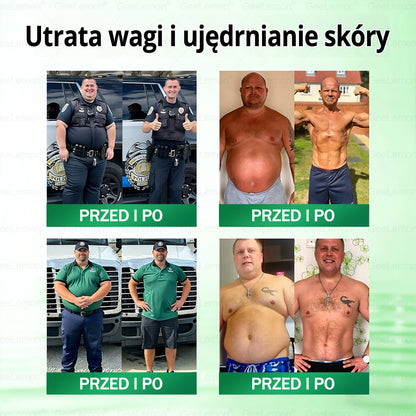 💖Oficjalny Sklep | 👩‍⚕️🎁 𝐆𝐞𝑒𝐿𝑒𝐦𝐨𝐧® 𝐆𝐥𝐮𝐦ase𝐭𝐢𝐝𝐞 𝟖 𝐰 𝟏 Smukły i Zdrowy Nano Plaster z Mikronakłuciami 🇵🇱(Tylko raz dziennie, widoczne zmiany już w 7 dni)✅ Na otyłość, 🅛🅞🅞🅢🅔 🅢🅚🅘🅝 wiotką skórę, cukrzycę, bezdech senny, problemy ze stawami i wiele więcej