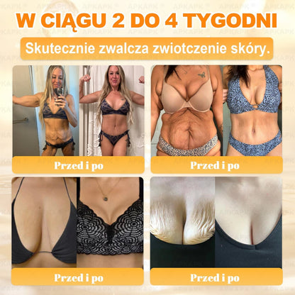 🐝ΑPΚΑPK® Jad Pszczoły Kompleksowy Krem✨pomaga w leczeniu problemów skórnych, takich jak: zmarszczki, blizny, plamy pigmentacyjne, rozstępy, trądzik, łuszczyca, egzema, zmiany skórne, podrażnienia, stany zapalne i inne problemy skórne🔥
