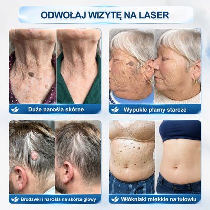 🍀👑Hiskin® 7 𝑫𝒏𝒊 𝑷𝒓𝒆𝒑𝒂𝒓𝒂𝒕 𝑫𝒐 𝑼𝒔𝒖𝒘𝒂𝒏𝒊𝒂 𝑾łó𝒌𝒏𝒊𝒂𝒌ó𝒘 𝑴𝒊ę𝒌𝒌𝒊𝒄𝒉 𝑰 𝑷𝒓𝒛𝒆𝒃𝒂𝒓𝒘𝒊𝒆ń(𝐁𝐞𝐳 𝐁ó𝐥𝐮, 𝐁𝐞𝐳 𝐁𝐥𝐢𝐳𝐧 – 𝐑𝐨𝐥𝐥-𝐨𝐧)