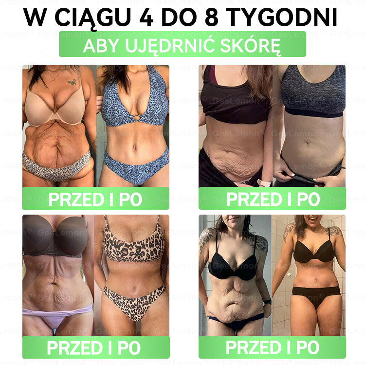 💖Oficjalny Sklep | 👩‍⚕️🎁 𝐆𝐞𝑒𝐿𝑒𝐦𝐨𝐧® 𝐆𝐥𝐮𝐦ase𝐭𝐢𝐝𝐞 𝟖 𝐰 𝟏 Smukły i Zdrowy Nano Plaster z Mikronakłuciami 🇵🇱(Tylko raz dziennie, widoczne zmiany już w 7 dni)✅ Na otyłość, 🅛🅞🅞🅢🅔 🅢🅚🅘🅝 wiotką skórę, cukrzycę, bezdech senny, problemy ze stawami i wiele więcej