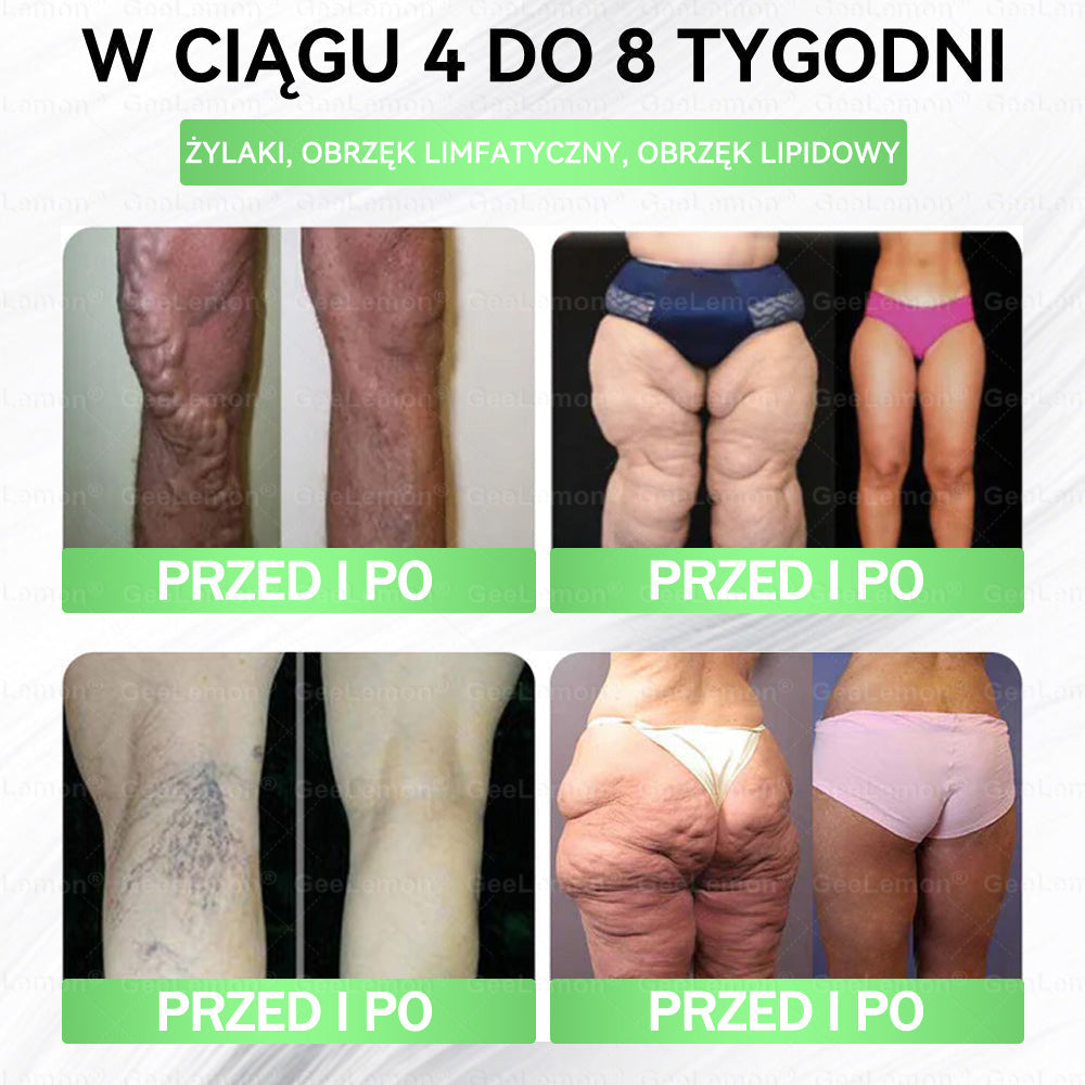 💖Oficjalny Sklep | 👩‍⚕️🎁 𝐆𝐞𝑒𝐿𝑒𝐦𝐨𝐧® 𝐆𝐥𝐮𝐦ase𝐭𝐢𝐝𝐞 𝟖 𝐰 𝟏 Smukły i Zdrowy Nano Plaster z Mikronakłuciami 🇵🇱(Tylko raz dziennie, widoczne zmiany już w 7 dni)✅ Na otyłość, 🅛🅞🅞🅢🅔 🅢🅚🅘🅝 wiotką skórę, cukrzycę, bezdech senny, problemy ze stawami i wiele więcej