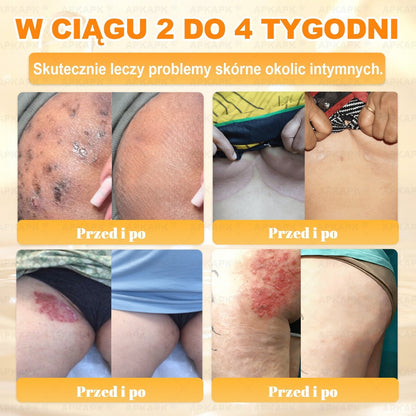 🐝ΑPΚΑPK® Jad Pszczoły Kompleksowy Krem✨pomaga w leczeniu problemów skórnych, takich jak: zmarszczki, blizny, plamy pigmentacyjne, rozstępy, trądzik, łuszczyca, egzema, zmiany skórne, podrażnienia, stany zapalne i inne problemy skórne🔥