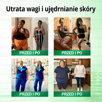 💖Oficjalny Sklep | 👩‍⚕️🎁 𝐆𝐞𝑒𝐿𝑒𝐦𝐨𝐧® 𝐆𝐥𝐮𝐦ase𝐭𝐢𝐝𝐞 𝟖 𝐰 𝟏 Smukły i Zdrowy Nano Plaster z Mikronakłuciami 🇵🇱(Tylko raz dziennie, widoczne zmiany już w 7 dni)✅ Na otyłość, 🅛🅞🅞🅢🅔 🅢🅚🅘🅝 wiotką skórę, cukrzycę, bezdech senny, problemy ze stawami i wiele więcej