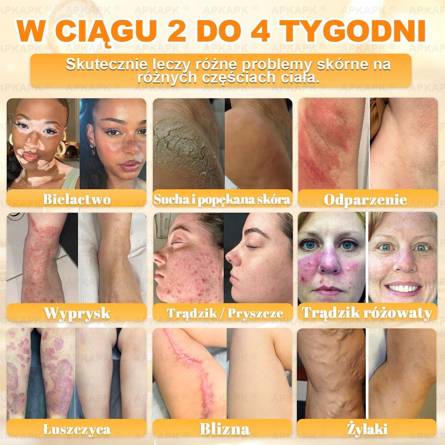 🐝ΑPΚΑPK® Jad Pszczoły Kompleksowy Krem✨pomaga w leczeniu problemów skórnych, takich jak: zmarszczki, blizny, plamy pigmentacyjne, rozstępy, trądzik, łuszczyca, egzema, zmiany skórne, podrażnienia, stany zapalne i inne problemy skórne🔥