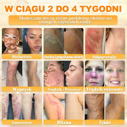 🐝ΑPΚΑPK® Jad Pszczoły Kompleksowy Krem✨pomaga w leczeniu problemów skórnych, takich jak: zmarszczki, blizny, plamy pigmentacyjne, rozstępy, trądzik, łuszczyca, egzema, zmiany skórne, podrażnienia, stany zapalne i inne problemy skórne🔥