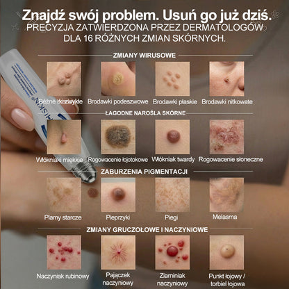 🍀👑Hiskin® 7 𝑫𝒏𝒊 𝑷𝒓𝒆𝒑𝒂𝒓𝒂𝒕 𝑫𝒐 𝑼𝒔𝒖𝒘𝒂𝒏𝒊𝒂 𝑾łó𝒌𝒏𝒊𝒂𝒌ó𝒘 𝑴𝒊ę𝒌𝒌𝒊𝒄𝒉 𝑰 𝑷𝒓𝒛𝒆𝒃𝒂𝒓𝒘𝒊𝒆ń(𝐁𝐞𝐳 𝐁ó𝐥𝐮, 𝐁𝐞𝐳 𝐁𝐥𝐢𝐳𝐧 – 𝐑𝐨𝐥𝐥-𝐨𝐧)