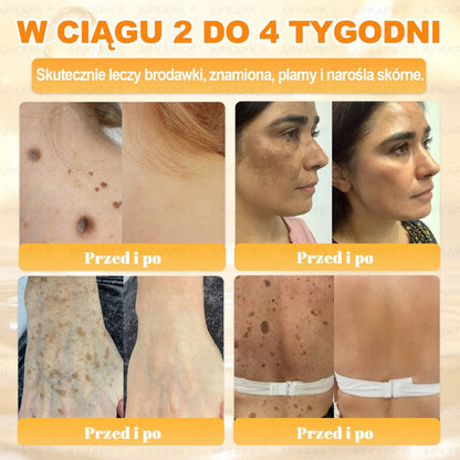 🐝ΑPΚΑPK® Jad Pszczoły Kompleksowy Krem✨pomaga w leczeniu problemów skórnych, takich jak: zmarszczki, blizny, plamy pigmentacyjne, rozstępy, trądzik, łuszczyca, egzema, zmiany skórne, podrażnienia, stany zapalne i inne problemy skórne🔥