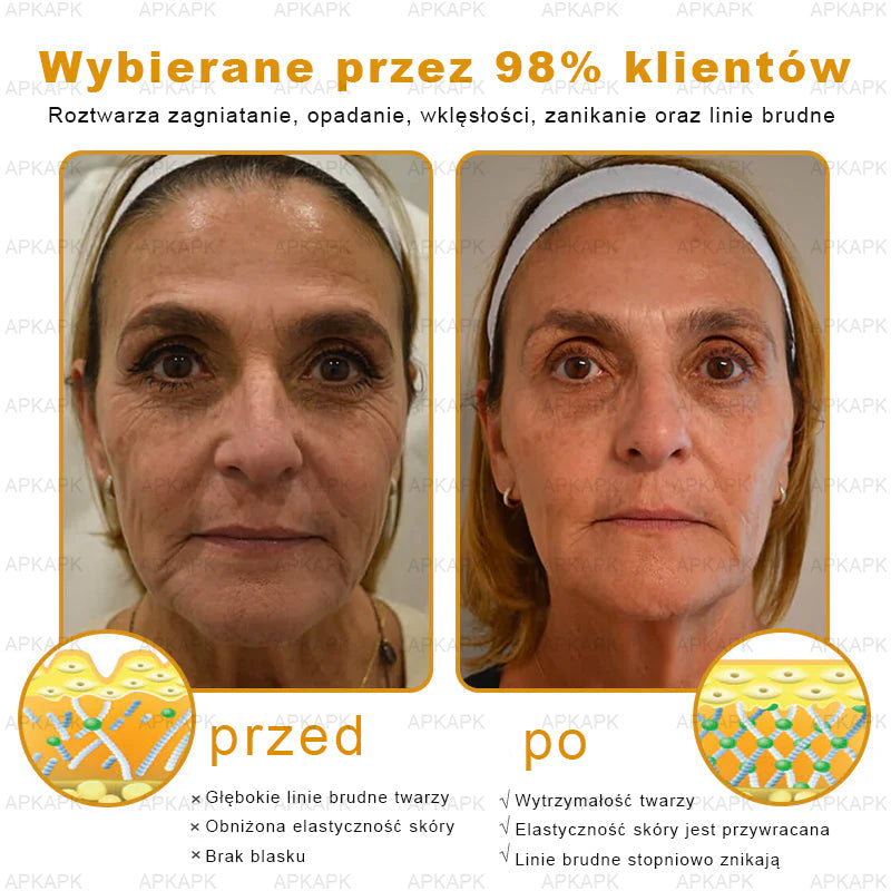 ΑPΚΑPK™ Jad Pszczoły Kompleksowy Krem🥇pomaga w leczeniu problemów skórnych, takich jak: zmarszczki, blizny, plamy pigmentacyjne, rozstępy, trądzik, łuszczyca, egzema, zmiany skórne, podrażnienia, stany zapalne i inne problemy skórne🔥